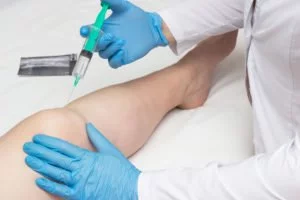 Patient receiving prolozone injections for joint pains