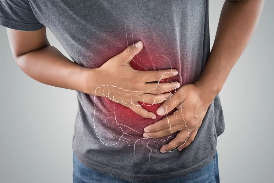 What is colitis, what are its causes and how can it be treated naturally