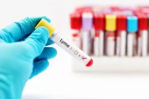 A lyme disease test is usually ordered by a practitioner when a patient displays symptoms of lyme disease