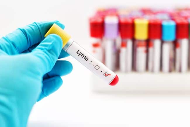 A Lyme disease test is usually ordered by a practitioner when a patient displays symptoms of Lyme disease