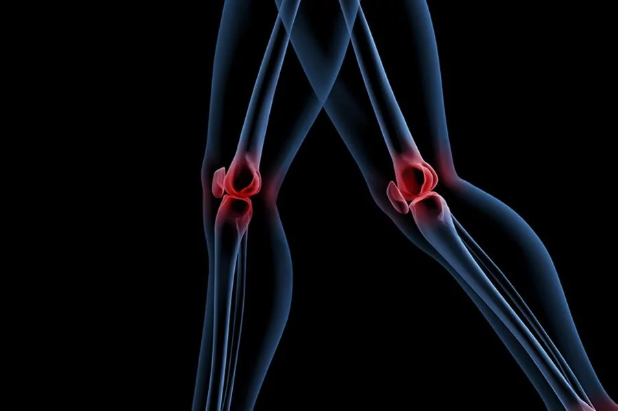 We treat knee pain successfully and naturally with prolozone