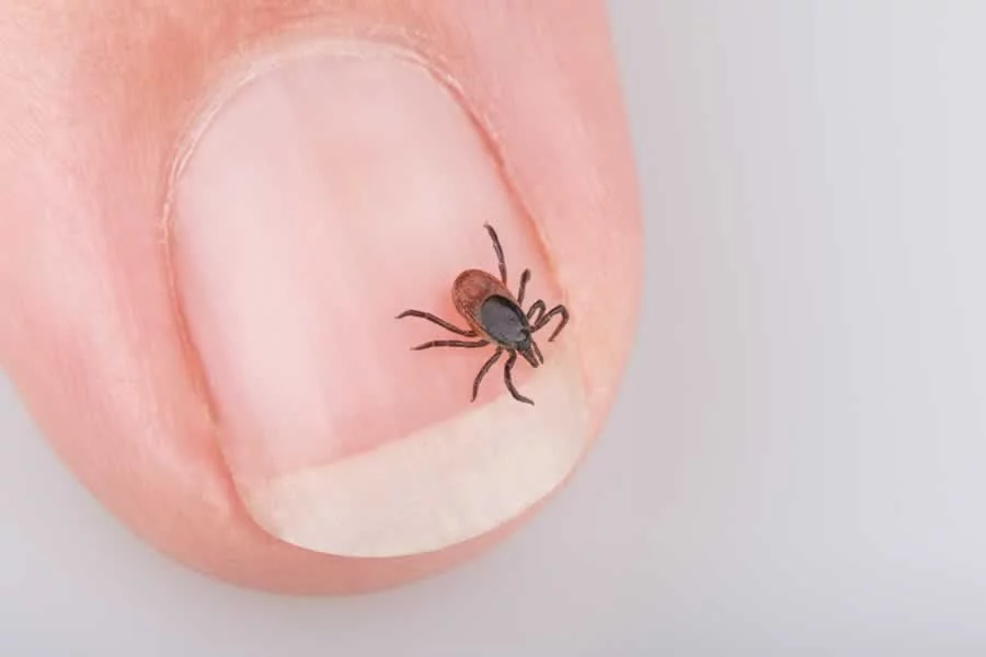 A Lyme disease carrying tick on someone's hand
