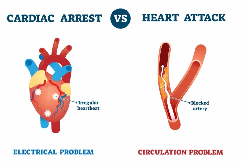 The Difference Between A Heart Attack & Cardiac Arrest