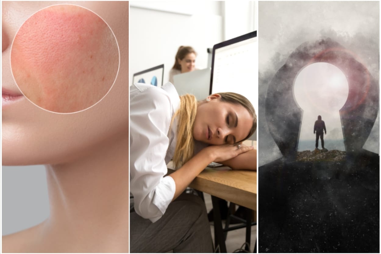 Three Major Signs That You Need a Body Detox: skin, fatigue, brain fog.