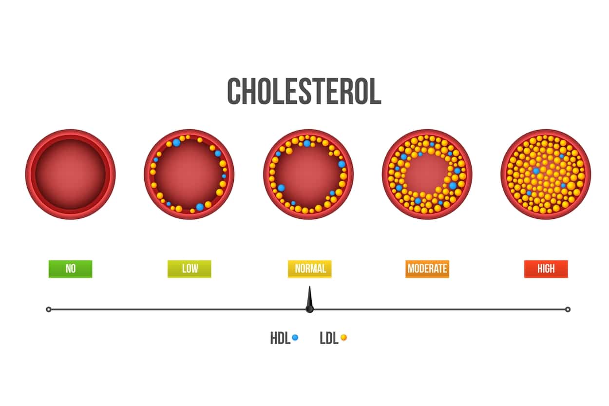 Image with range of cholesterol from No to Low to Normal to Moderate and High