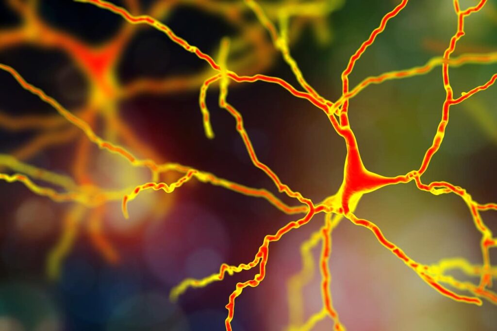 multiple sclerosis - a complex network of cells and wiring (nerves).