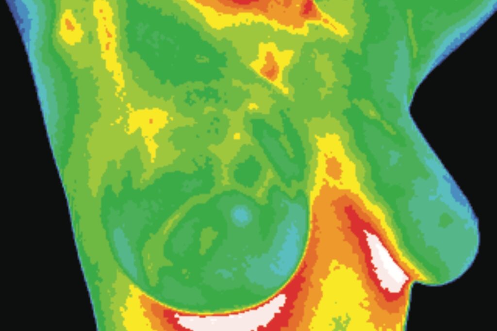 Thermography Appointment